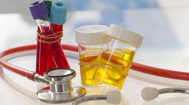 Urine and blood samples alongside a stethoscope