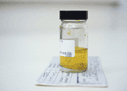 A urine specimen