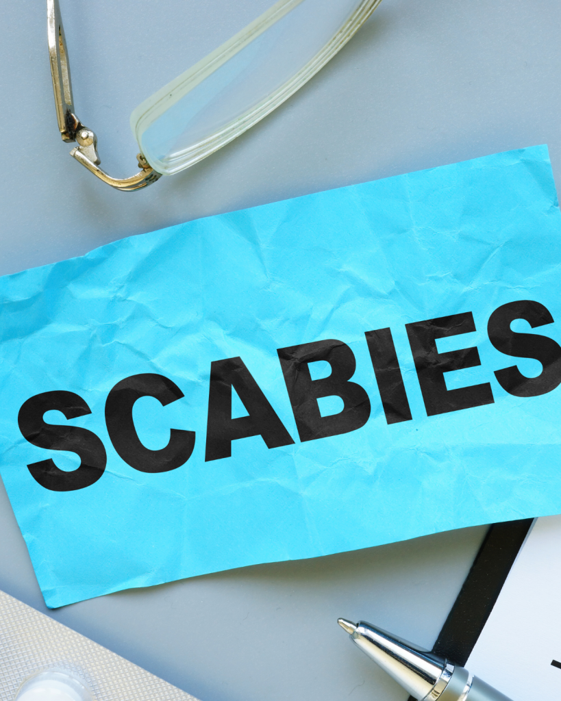 Scabies