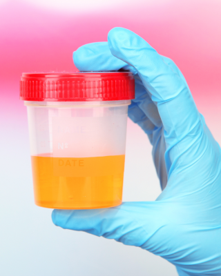 A urine sample